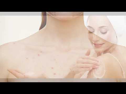 Causes Of Pimples And Acne - आपके बॉडी पर हुए एक्ने का क्या कारण है, बताएगा ये वीडियो। how to get rid of pimples in ear
