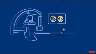 The Direct to Angio Suite workflow at a glance