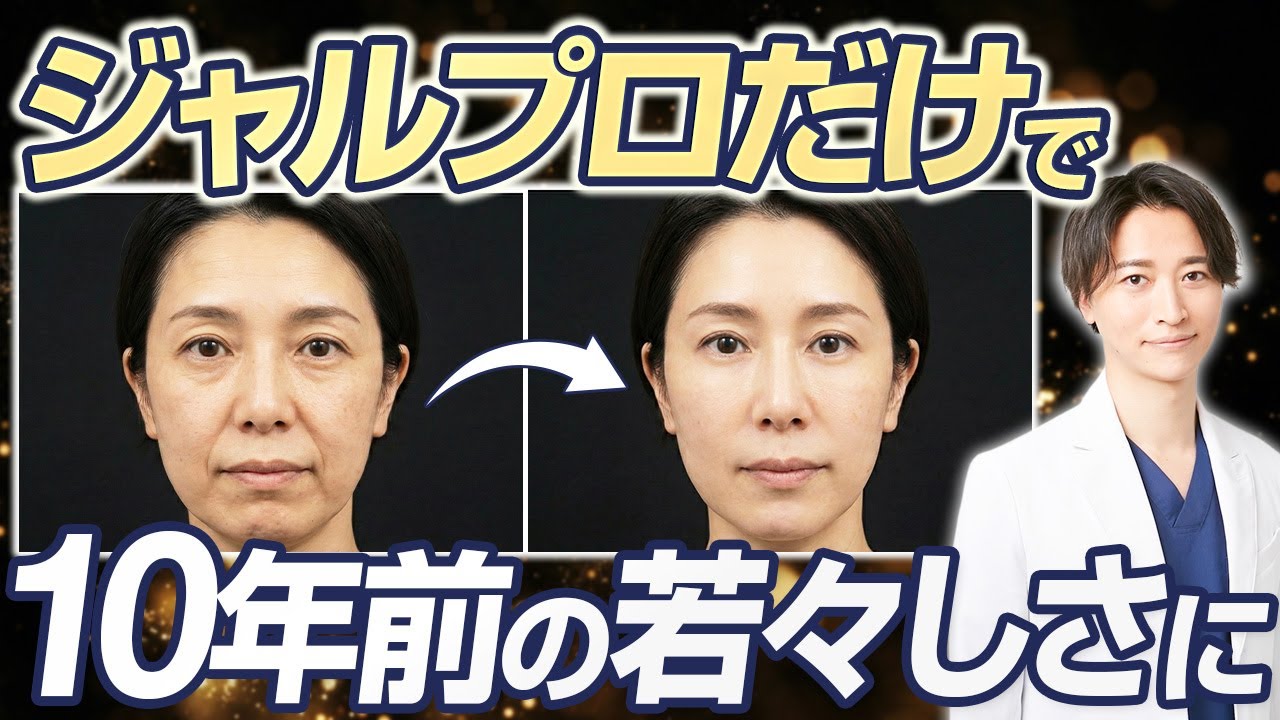 自然な若々しさならジャルプロスーパーハイドロ一択！ハリ・潤い・ツヤ全てが手に入る？【若返り・たるみ治療・アンチエイジング】