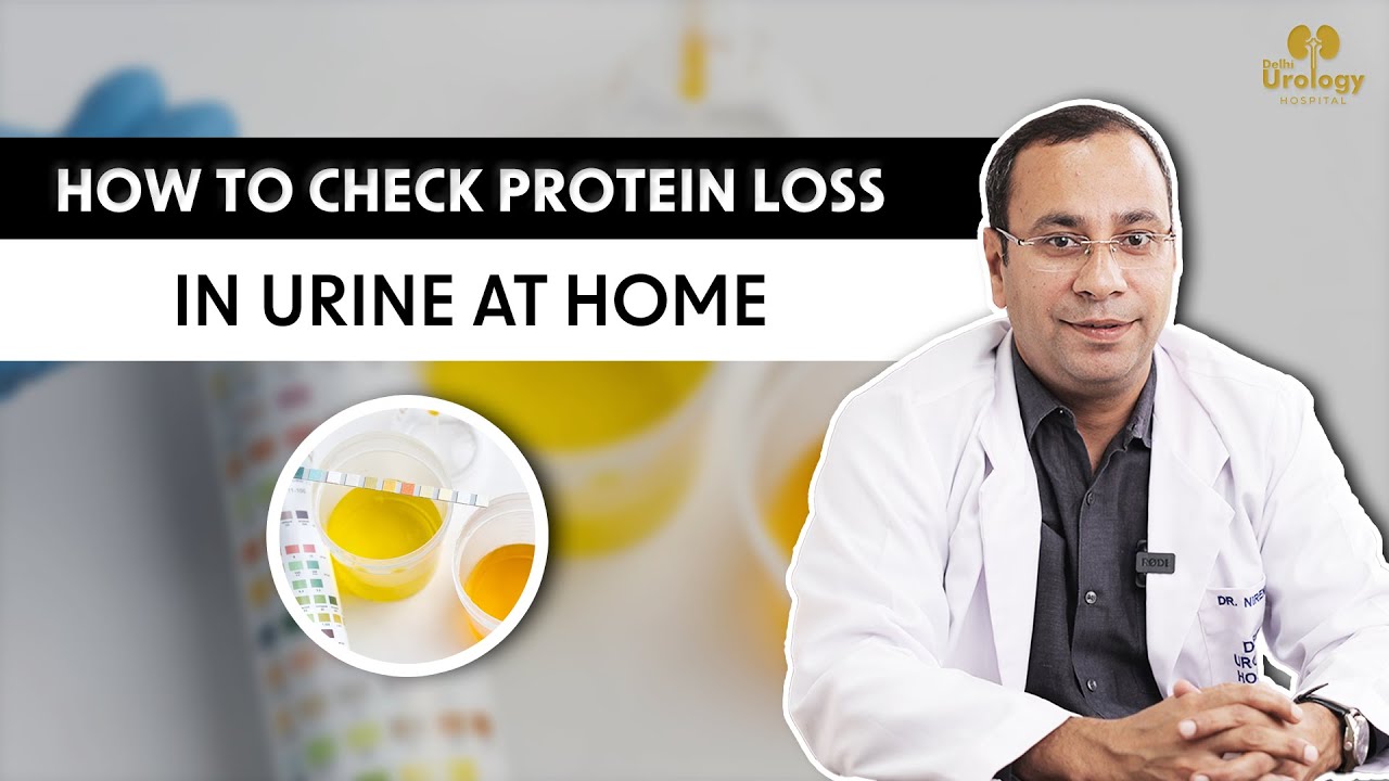 How to check Protein Loss in urine Peshab me Jhag aane ke kya karan