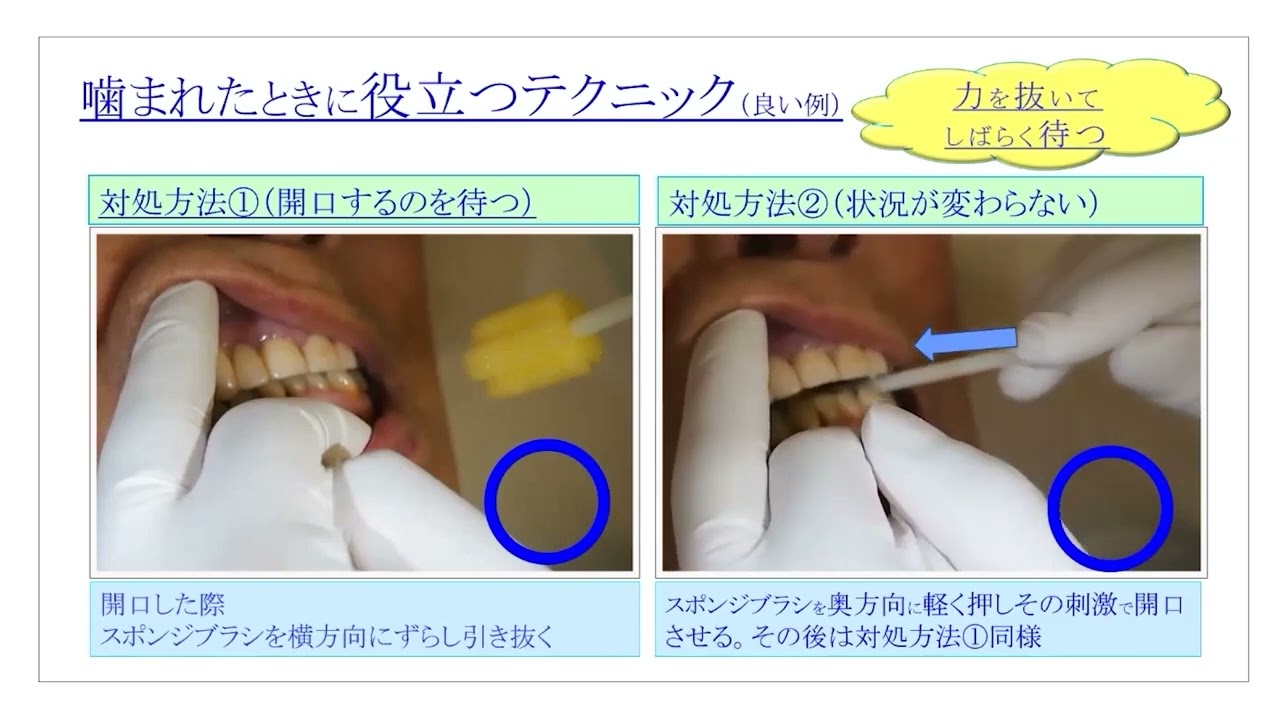 訪問口腔衛生管理の実際 ～役立つテクニック～ – 株式会社デジタル