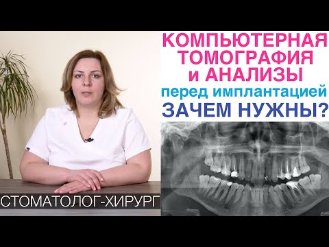 Имплантация зубов - зачем нужны компьютерная томография и анализы перед установкой зубного импланта?