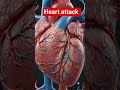 Heart attack #viral #viralvideo #neet #biology #shorts