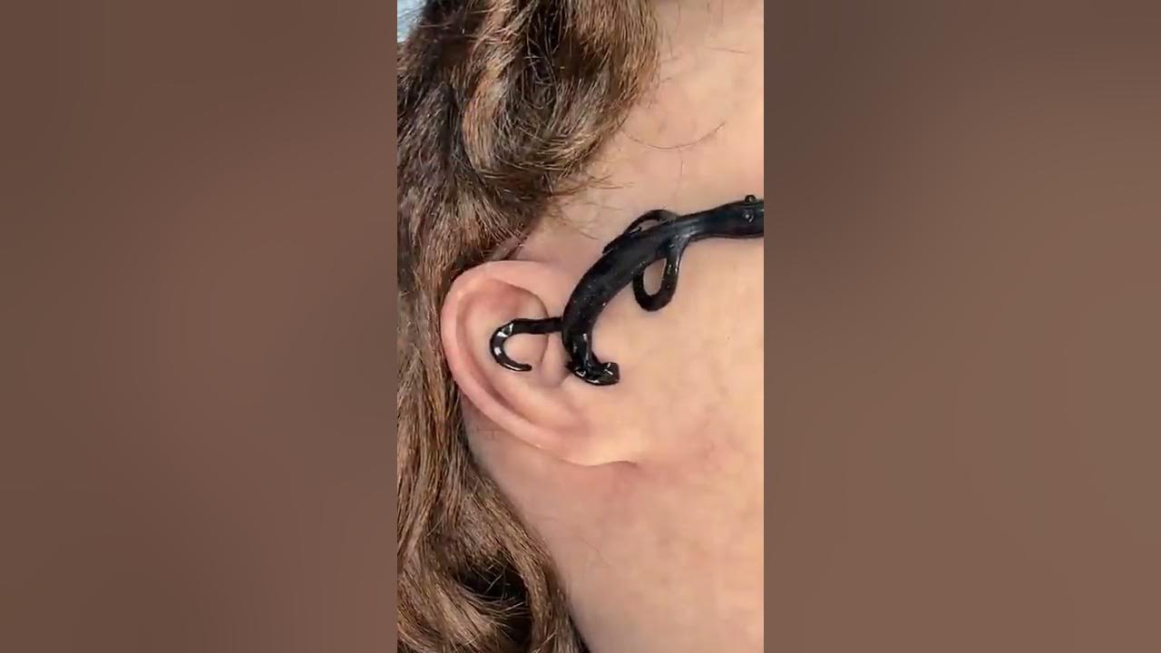 Strange Insect Removed From Ear. #Ear#insect - YouTube