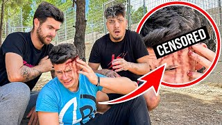 Álex Segura Sufre Un Accidente