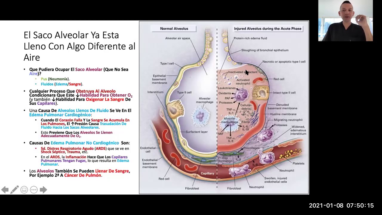 Sistema Respiratorio Fisiopatologia TM