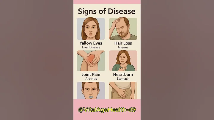 6 Warning Signs Your Body Is in Trouble ⚠️ | Don’t Ignore These Symptoms! #healthover40 #facts #food