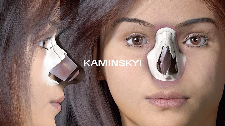 3D animation: rhinoplasty for the crooked nose, septum deviation ⭕️  KAMINSKYI