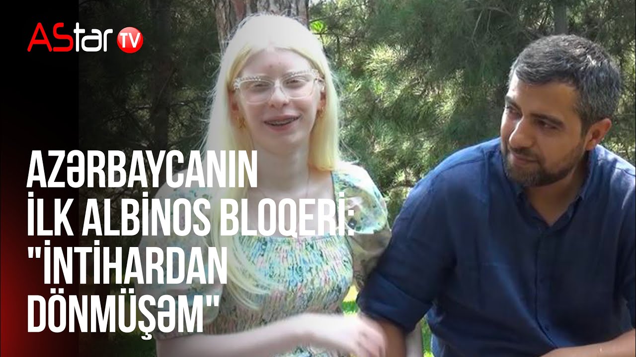 Azərbaycanın ilk albinos bloqeri: 