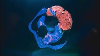 Download lagu yetep - Hate It When It's You (ft. Trella) | Lost In Dreams Records