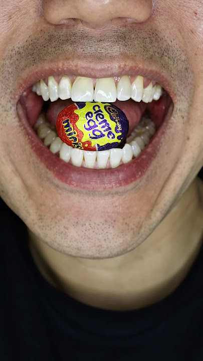ASMR | Creme Egg Minis fun begins | Eat the chocolate not the wrapper 😂🍫 #DoctorTristanPeh #ASMR