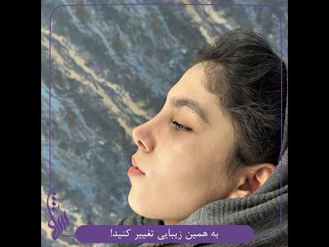 تغییرات یه ماهه رو ببینید کجا خفن تر از شانا شماره مشاورین ما ۰۹۰۳۲۲۲۲۶۷۵ ۰۹۰۱۲۲۲۲۶۷۵