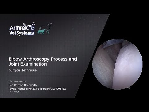 Elbow Arthroscopy Process and Joint Examination