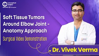 Soft Tissue Tumors Around Elbow By Dr. Vivek Verma | Conceptual Surgery screenshot 2