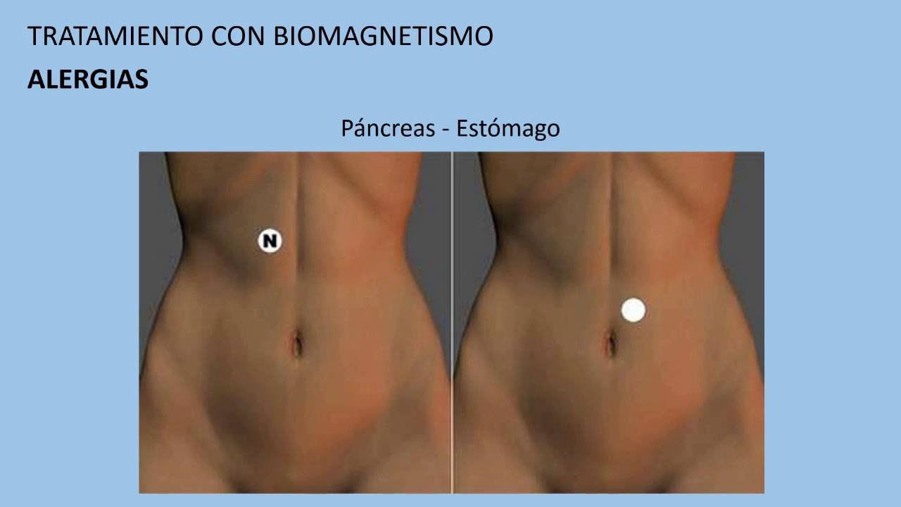 Sirve el biomagnetismo para adelgazar