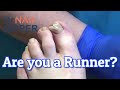 Toenails Only Another Runner Could Love (2020)