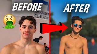 HOW I GOT RID OF MY ACNE !