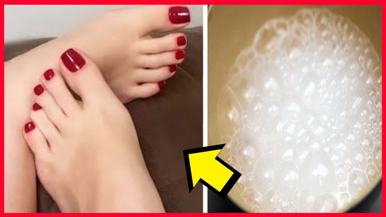 weight loss diet Feet Whitening Home Remedies - Amazing Beauty Tips For Feet Whitening | Feet Whitening