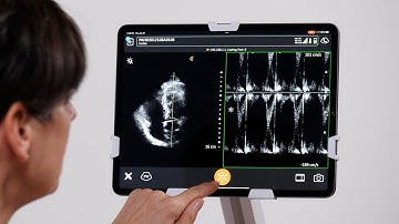 Pulsed Wave (PW) Doppler
