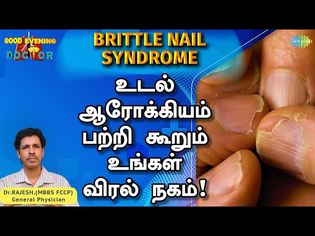 Loceryl Nail in Tamil பயன்பாடுகள், மருந்தளவு, பக்க விளைவுகள், நன்மைகள்,  தொடர்புகள் மற்றும் எச்சரிக்கைகள் - Loceryl Nail payanpaadugal,  marundhalavu, pakka vilaivugal, nanmaigal ...