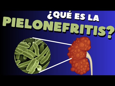 Video: ¿Cuáles son las principales causas de la pielonefritis?