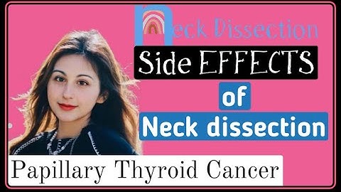 Neck Dissection side effects & surgery Detail Video | Thyroid Cancer (Metastatic)