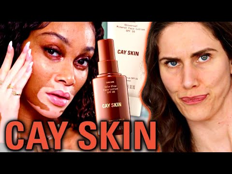 A Celebrity Skincare Line That ISN’T A CASH GRAB?!?! Winnie Harlow’s Cay Skin