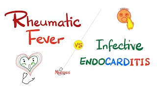 Rheumatic Fever vs Infective Endocarditis  Comparison  Cardiology Series