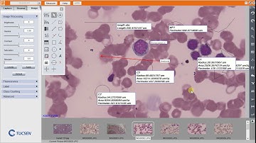 Measurements in TUCSEN Camera Software