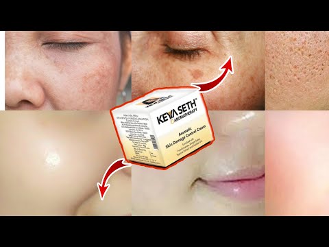 ?खराब त्वचा को कहो अलविदा,Keyaseth skin damage control cream,ORGANIC YOU,