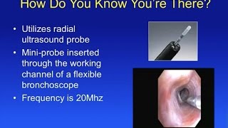 Practical tips to optimize your Radial EBUS Sampling of The Peripheral Lung Nodule screenshot 1