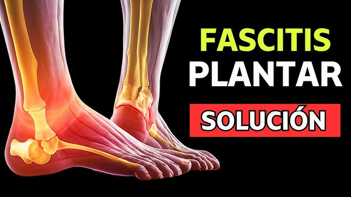 Las mejores zapatillas para correr y evitar la dolorosa fascitis