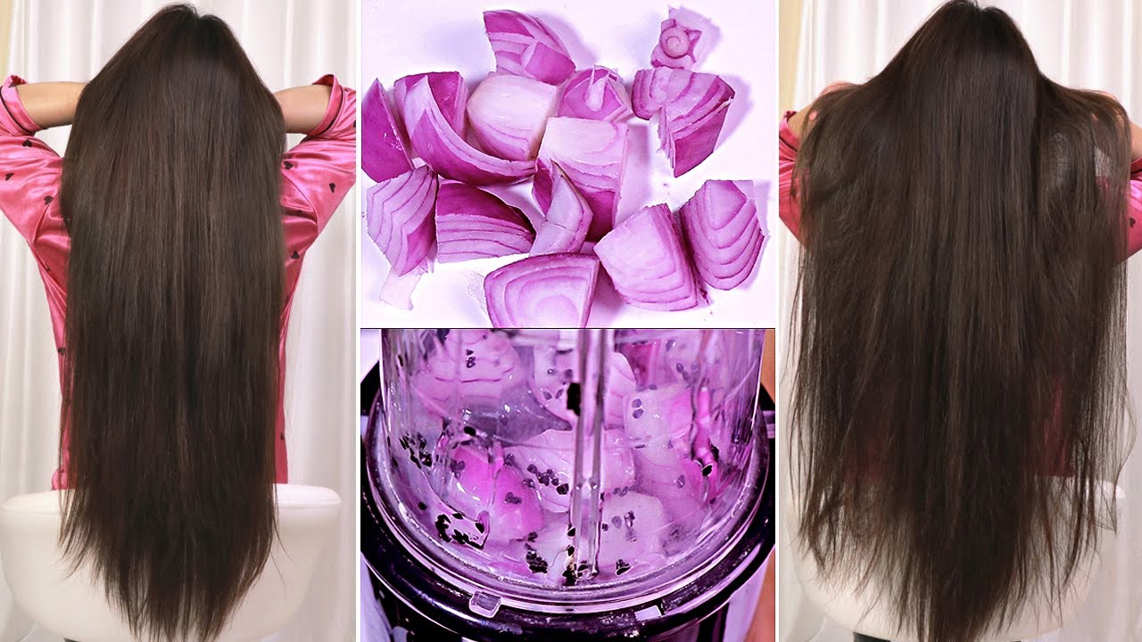 Top 5 "Summer" Hair Growth Challenge How can You Speed up Hair Growth