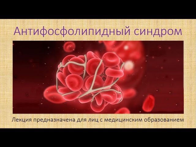Антифосфолипидный синдром