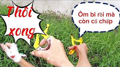 Đi săn cá thòi lòi, Bắn vào tay 2 viên tới xương