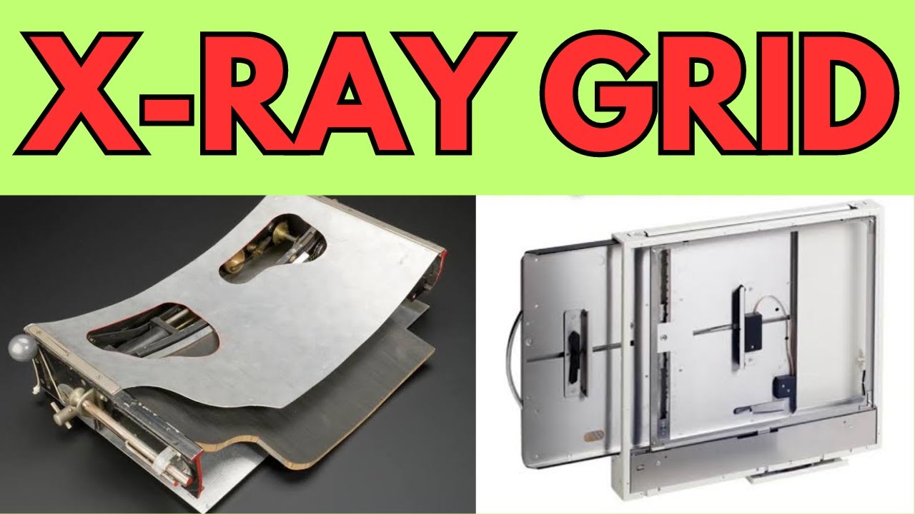 X ray Grid Construction Of X ray Grid Grids In Radiology Anti X ray Grid Construction Of X ray Grid Grids In Radiology Anti