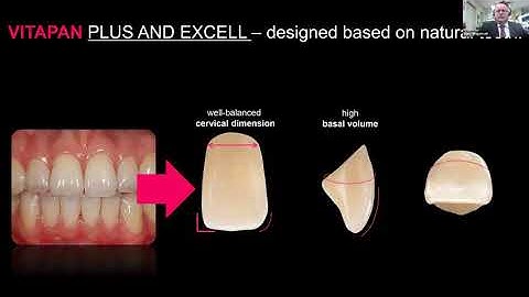 Making the Shift in Your Denture Teeth to VITA Prosthetics - The Freedom of Change.