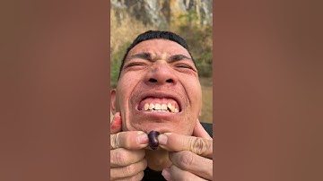 How I Cured a Bug Bite with Yogurt in the Wild | Survival Hacks😫🤣😂