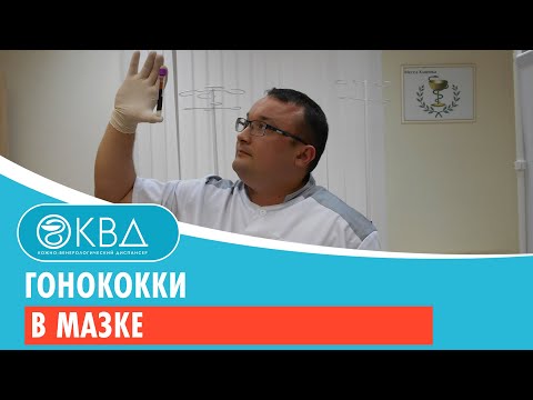 Гонококки в мазке Гонококки в мазке