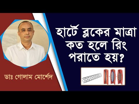 ভিডিও: আপনি কি স্টেন্টের জন্য প্রিমেড করেছেন?