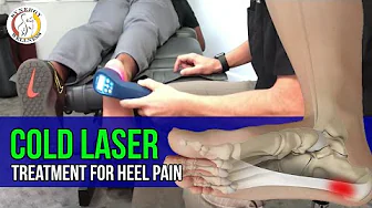 Cold Laser Treatment for Heel Pain and Plantar Fasciitis  {low level laser therapy}