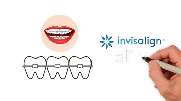 All About Invisalign ClinCheck 6.0