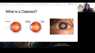 Keeping Your Eyes Healthy: Cataracts and Glaucoma