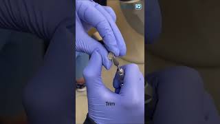 Temporary crown tips with Dr. Tami #shorts screenshot 1