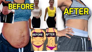 KIAT JUD DAI 5 MINUTES ONLINE WORKOUT TO MELT BELLY FAT IN 5 DAYS