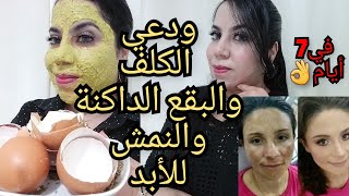 وأخيراأنجح وصفة صحراوية لإزالة الكلف والبقع الداكنة والنمش4kإزالة الحبوب وآثار الحبوب وتصبغات الوجه