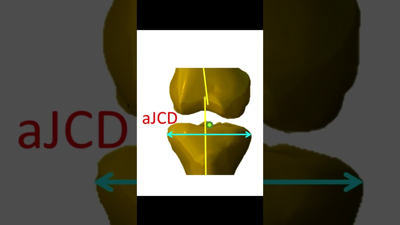 aJCR Es la relación entre la aJCD y el ancho total de la articulación