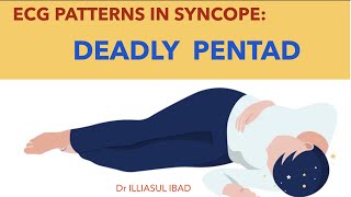 ECG PATTERNS IN SYNCOPE  : DEADLY PENTAD