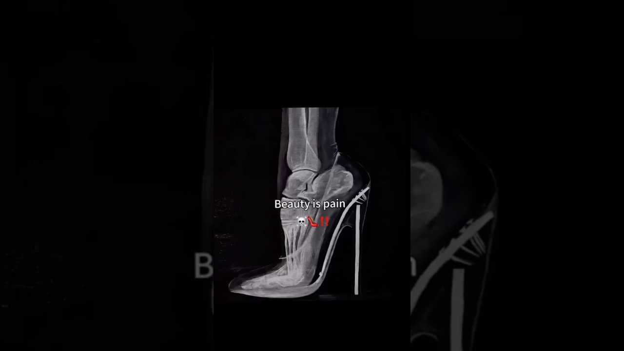 Beauty is PAIN☠️