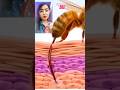 Why a Bee Sting Hurts? : Real science #shorts